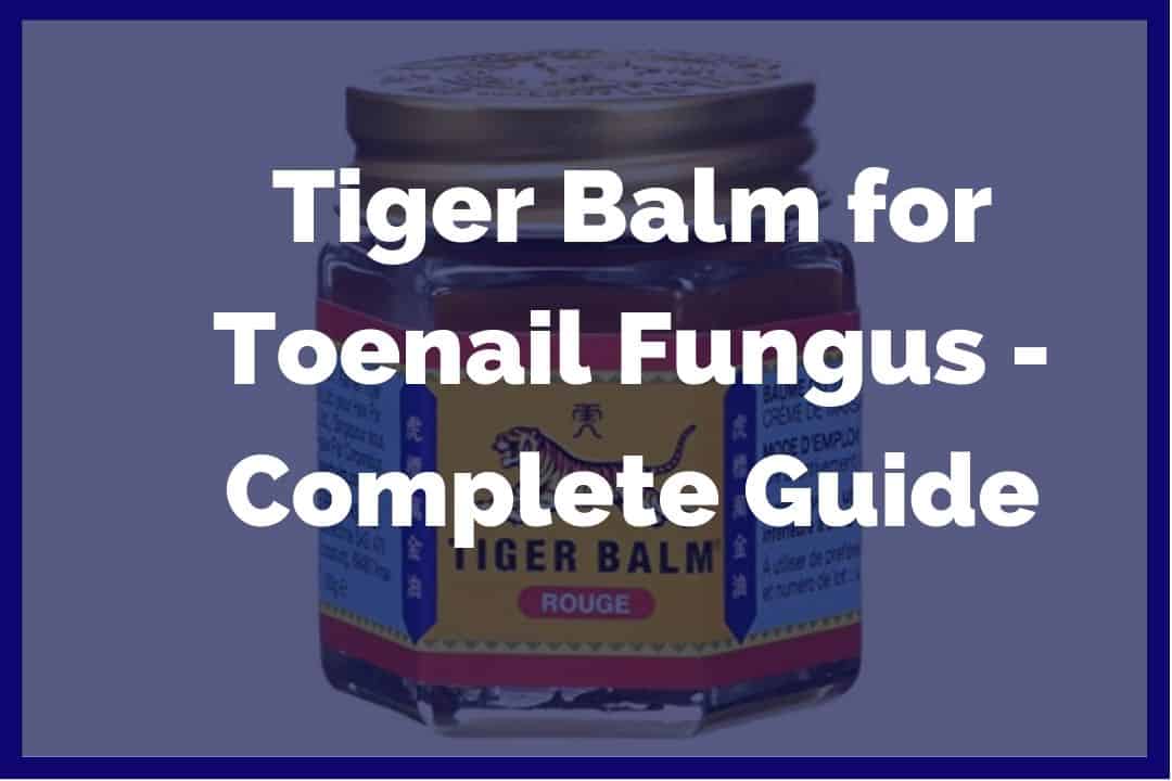 Tiger balm complete guide for fungus