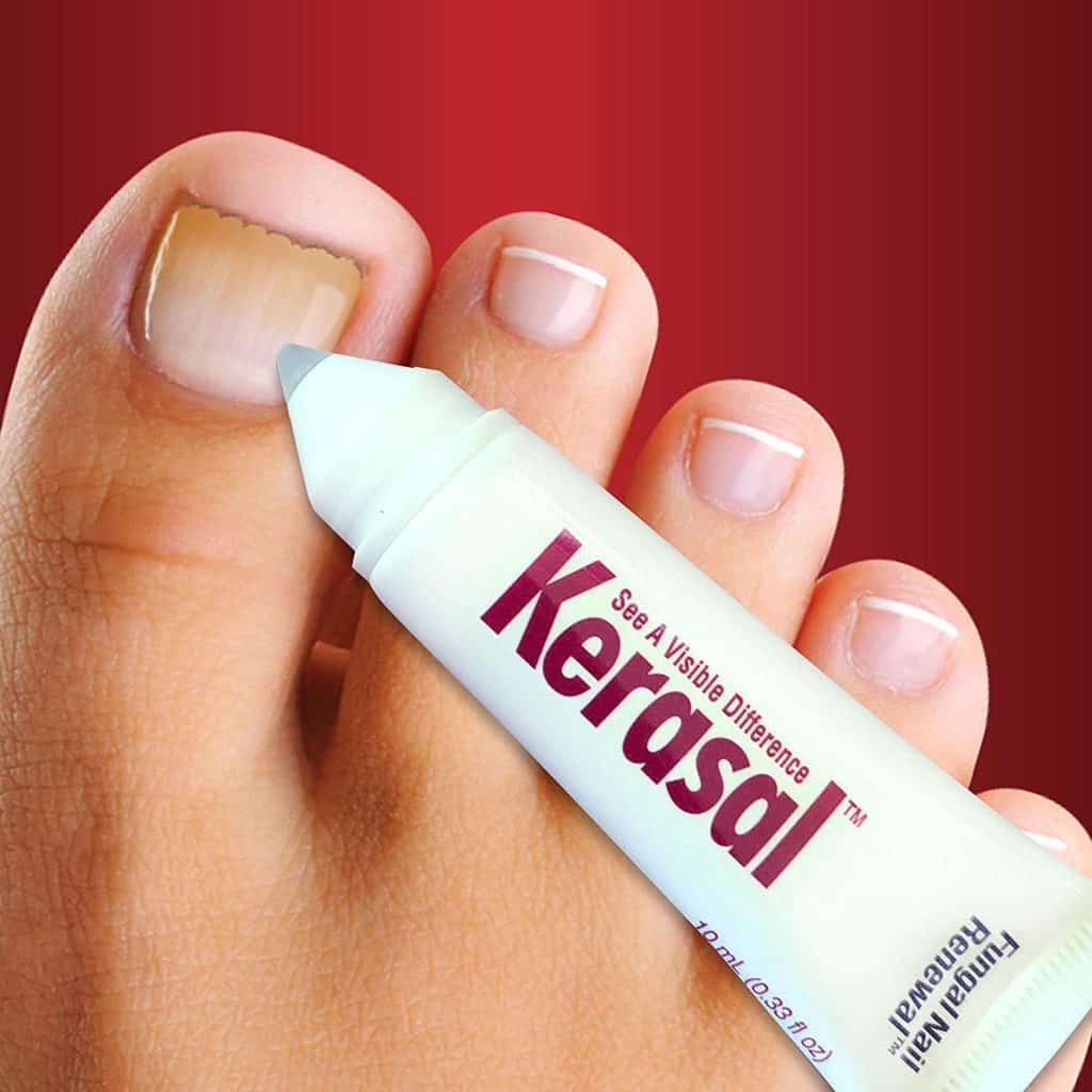 a-real-and-honest-review-of-kerasal-nail-renewal-toe-fungus-journey